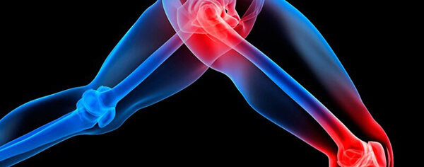 Delayed-Onset Muscle Soreness (DOMS) and How to Treat It